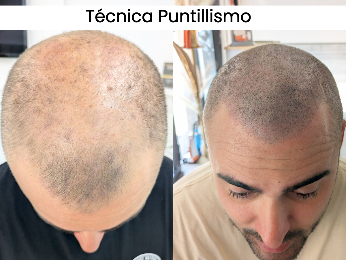 Tecnica clasica Puntillismo Micro Capilar